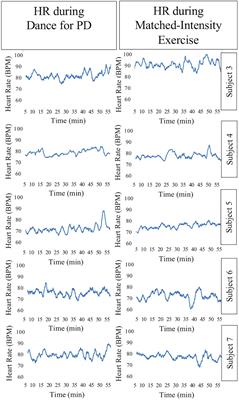 Beauty That Moves: Dance for Parkinson’s Effects on Affect, Self-Efficacy, Gait Symmetry, and Dual Task Performance